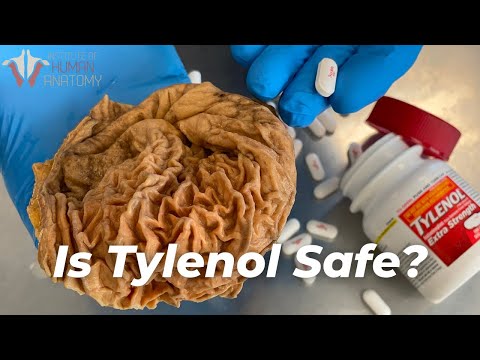 Should You Stop Taking Tylenol? (Acetaminophen/Paracetamol)