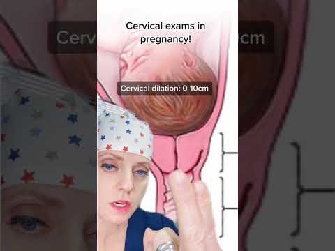 Cervical exams explained!
