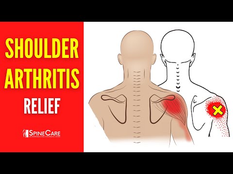 How to Relieve Shoulder Arthritis Pain in 30 SECONDS