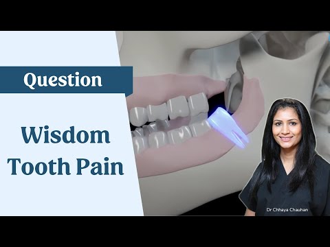 Wisdom tooth pain and advice